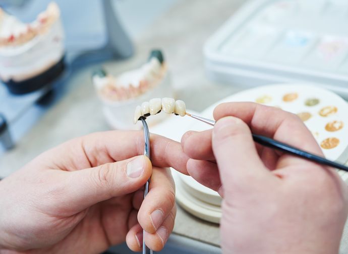 Protesi ed estetica dentale